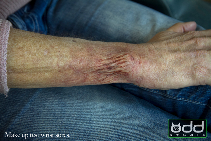 wrist sore